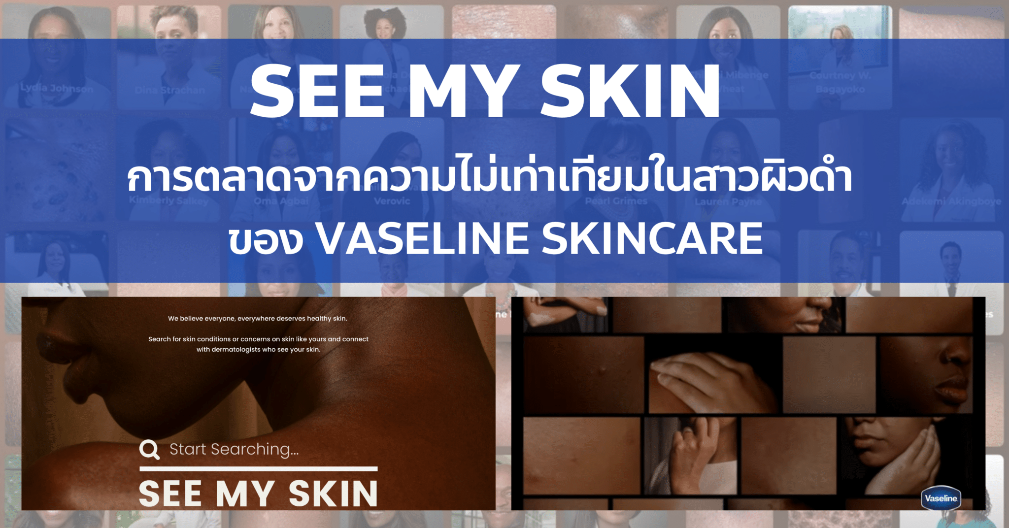 See my skin แคมเปญ จากความไม่เท่าเทียมในสาวผิวดำ ของ Vaseline