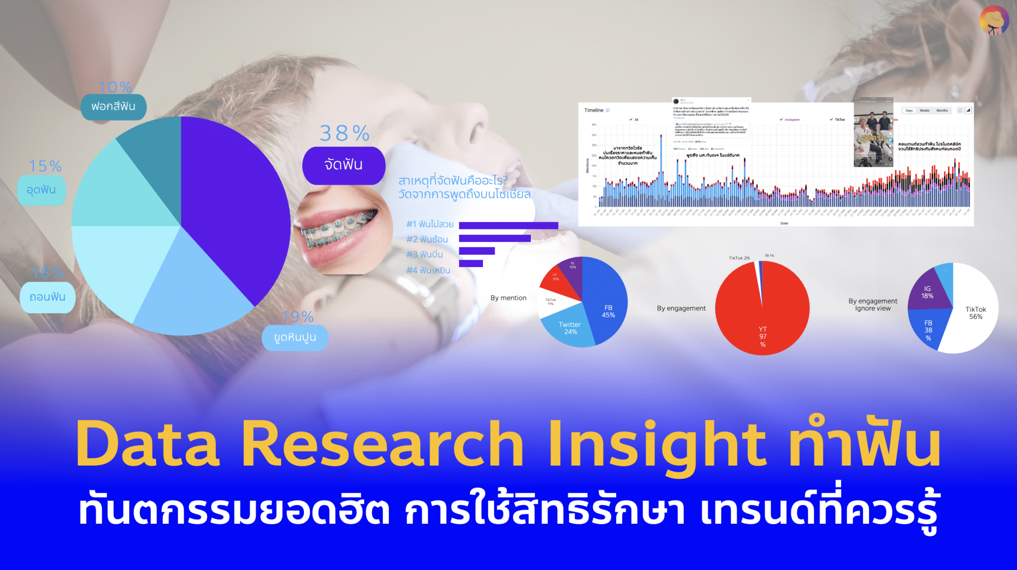 Data Research Insight ทำฟัน – ทันตกรรมยอดฮิต พร้อมเทรนด์ที่ควรรู้